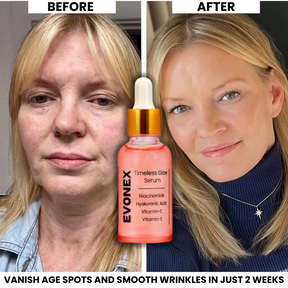 Evonex® - Age Defying Foundation, Anti-aging Serum, Universal